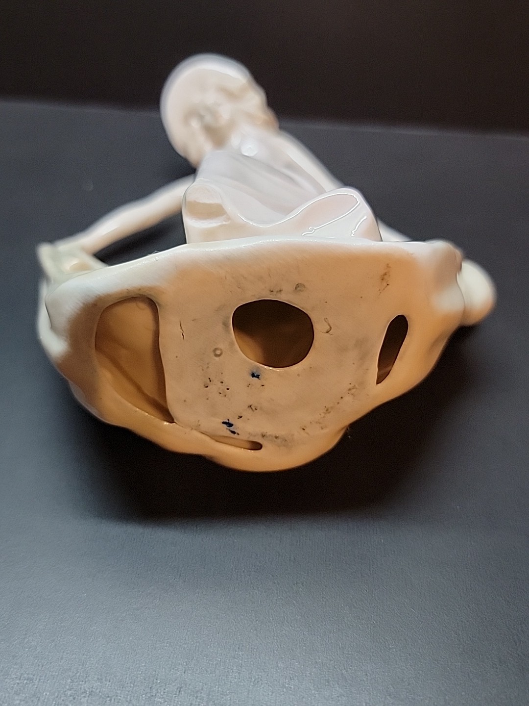Vintage May Dance Porcelain Figurine *Damaged Missing Foot*